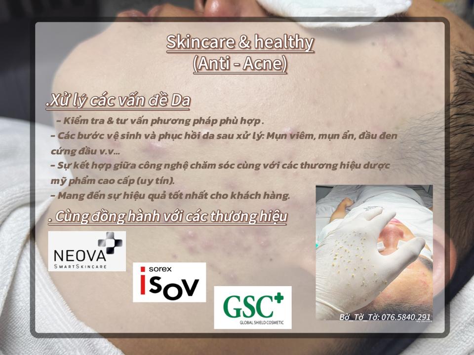 Meso Peel plus’s-duoc-ban-tai-Bờ Tờ Tờ