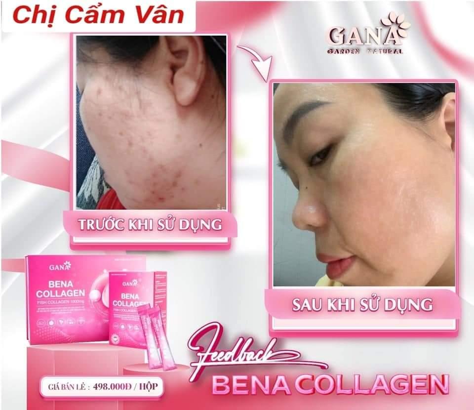 🍓#BENA_COLLAGEN SX THEO CÔNG NGHỆ HÀN QUỐC🍓
🍇BENA COLLAGEN  - SP uống siêu đẹp da cao cấp - hương trái cây 💖💯
👉HỘP 30 GÓI. 
♨Ngăn chặn sự hình thành các nếp nhăn, tăng tính đàn hồi & săn chắc của làn da, giúp da căng bóng.
♨Tăng cường độ ẩm & cải thiện sắc tố da, tóc.
♨Cung cấp chất chống oxy hóa bảo vệ da chống lại các tia cực tím có hại.
♨Bổ sung dinh dưỡng giúp tóc, móng dày & bóng hơn.
♨Phòng ngừa loãng xương & giảm đau khớp.
☑ BENA CLLAGEN được kết hợp các vitamin, các loại thảo dược, vì vậy chỉ cần 1 -2 gói #BENA_COLAGEN mỗi ngày thôi là làn da và sức khỏe của bạn sẽ được cải thiện rõ rệt.
Giá 497K 
Số lượng 1️⃣
☎️ 0797254043-duoc-ban-tai-PHƯƠNG LINH Shop