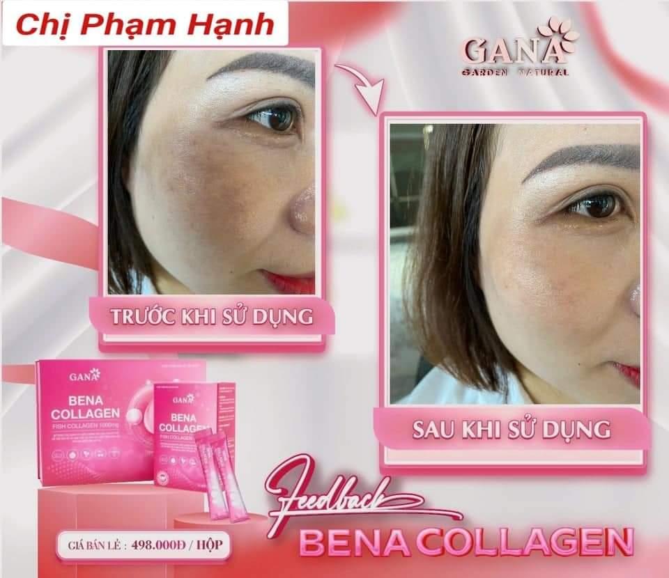 🍓#BENA_COLLAGEN SX THEO CÔNG NGHỆ HÀN QUỐC🍓
🍇BENA COLLAGEN  - SP uống siêu đẹp da cao cấp - hương trái cây 💖💯
👉HỘP 30 GÓI. 
♨Ngăn chặn sự hình thành các nếp nhăn, tăng tính đàn hồi & săn chắc của làn da, giúp da căng bóng.
♨Tăng cường độ ẩm & cải thiện sắc tố da, tóc.
♨Cung cấp chất chống oxy hóa bảo vệ da chống lại các tia cực tím có hại.
♨Bổ sung dinh dưỡng giúp tóc, móng dày & bóng hơn.
♨Phòng ngừa loãng xương & giảm đau khớp.
☑ BENA CLLAGEN được kết hợp các vitamin, các loại thảo dược, vì vậy chỉ cần 1 -2 gói #BENA_COLAGEN mỗi ngày thôi là làn da và sức khỏe của bạn sẽ được cải thiện rõ rệt.
Giá 497K 
Số lượng 1️⃣
☎️ 0797254043-duoc-ban-tai-PHƯƠNG LINH Shop