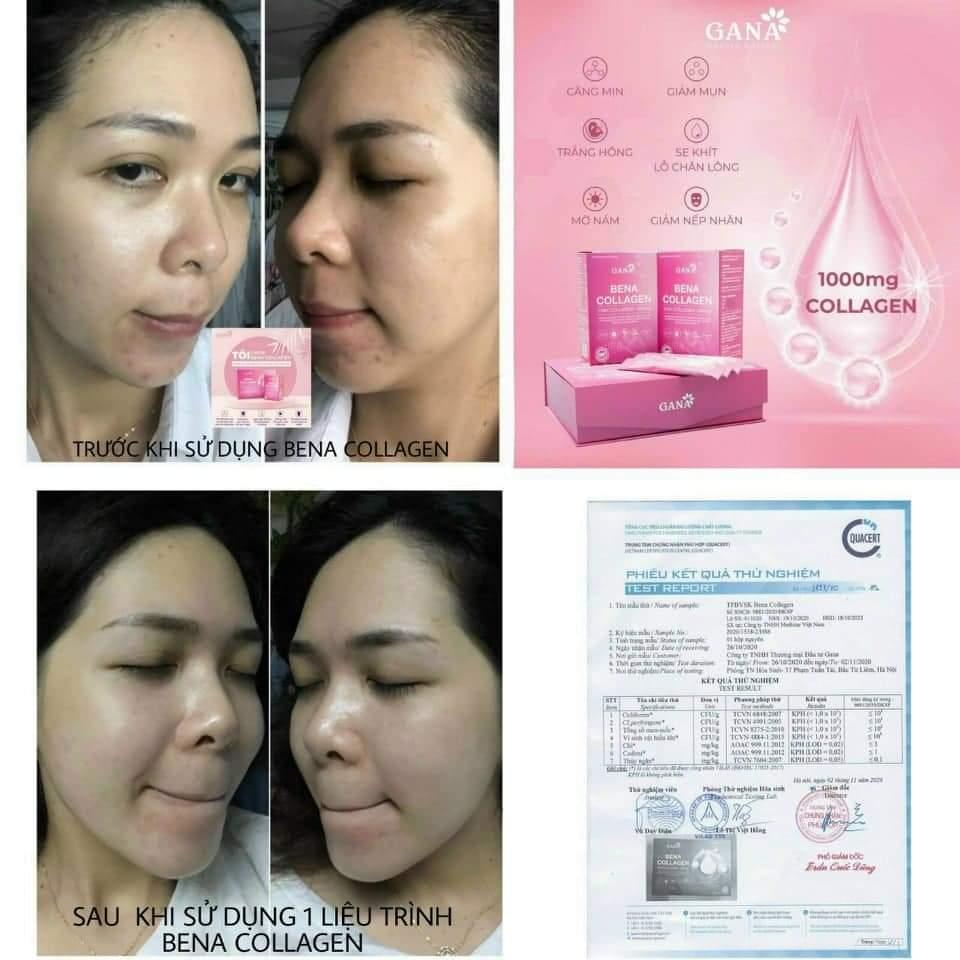 🍓#BENA_COLLAGEN SX THEO CÔNG NGHỆ HÀN QUỐC🍓
🍇BENA COLLAGEN  - SP uống siêu đẹp da cao cấp - hương trái cây 💖💯
👉HỘP 30 GÓI. 
♨Ngăn chặn sự hình thành các nếp nhăn, tăng tính đàn hồi & săn chắc của làn da, giúp da căng bóng.
♨Tăng cường độ ẩm & cải thiện sắc tố da, tóc.
♨Cung cấp chất chống oxy hóa bảo vệ da chống lại các tia cực tím có hại.
♨Bổ sung dinh dưỡng giúp tóc, móng dày & bóng hơn.
♨Phòng ngừa loãng xương & giảm đau khớp.
☑ BENA CLLAGEN được kết hợp các vitamin, các loại thảo dược, vì vậy chỉ cần 1 -2 gói #BENA_COLAGEN mỗi ngày thôi là làn da và sức khỏe của bạn sẽ được cải thiện rõ rệt.
Giá 497K 
Số lượng 1️⃣
☎️ 0797254043-duoc-ban-tai-PHƯƠNG LINH Shop