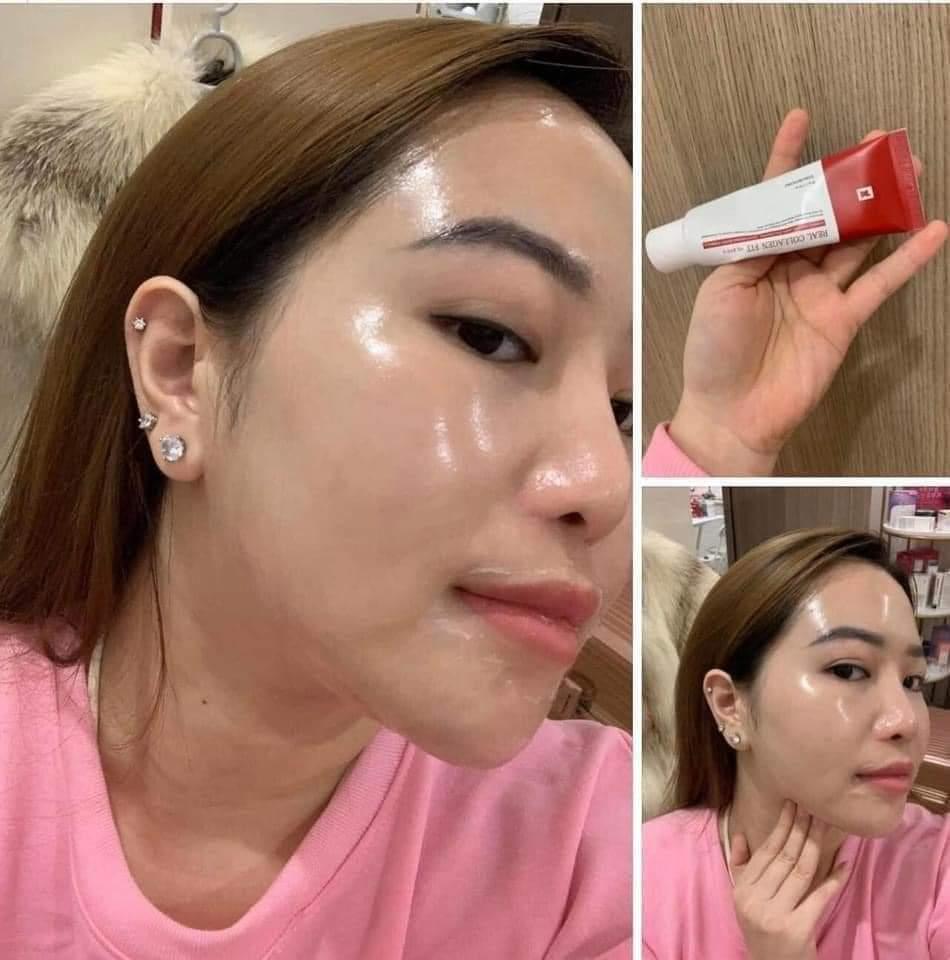 Muốn da đẹp thì cách duy nhất là Peel nha mấy b
💥Tự tin là em #Peel collagen này peel xong da đẹp căng bóng như mới tiêm bottox xong ấy.
👉 -Riêng loại này peel dễ cực kì, 1-2 tiếng Nhìn da đã khác bọt rồi.  1 lần peel bằng 3-4 tháng dưỡng da chăm chỉ nha các bà. 
Đẩy colagen vào da ngay lập tức da trở nên căng bóng, giảm nếp nhăn , rãnh cười cực hiệu quả
👇👇 -Không gây bong tróc giống các loại khác dễ Peel .
     ❌ Peel collagen nano Tosowoong Real Collagen Fit Cream Pack ❌
✅CÔNG DỤNG :
 - Collagen thuỷ phân 670.000ppm Giúp làn da mịn màng, trắng da, da khỏe mạnh và căng bóng
- Chiết xuất từ  Vitamin nhóm B : Giàu dinh dưỡng & dưỡng ẩm phục hồi da, giúp da căng bóng, trắng hồng.
- Madecassoside dưỡng ẩm cho da đặc biệt là da nhạy cảm, dịu da.
- glutathione : trắng sáng - đều màu da, chống oxy hoá.
- Tái tạo làn da giúp da trở nên căng bóng - mịn mướt .
Peel da đẹp lên ngay sau peel nhé, nhẹ nhàng, êm dịu tựa đắp mask thôi  không hề đau xót gì đâu nha🩸🩸
Mùa khô hanh này có em này, làn da như được tái sinh sau mỗi lần peel.
Peel collagen, truyền trắng, căng bóng
Giá bán lẻ 320K
Số lượng 1️⃣
☎️ 0797254043-duoc-ban-tai-PHƯƠNG LINH Shop