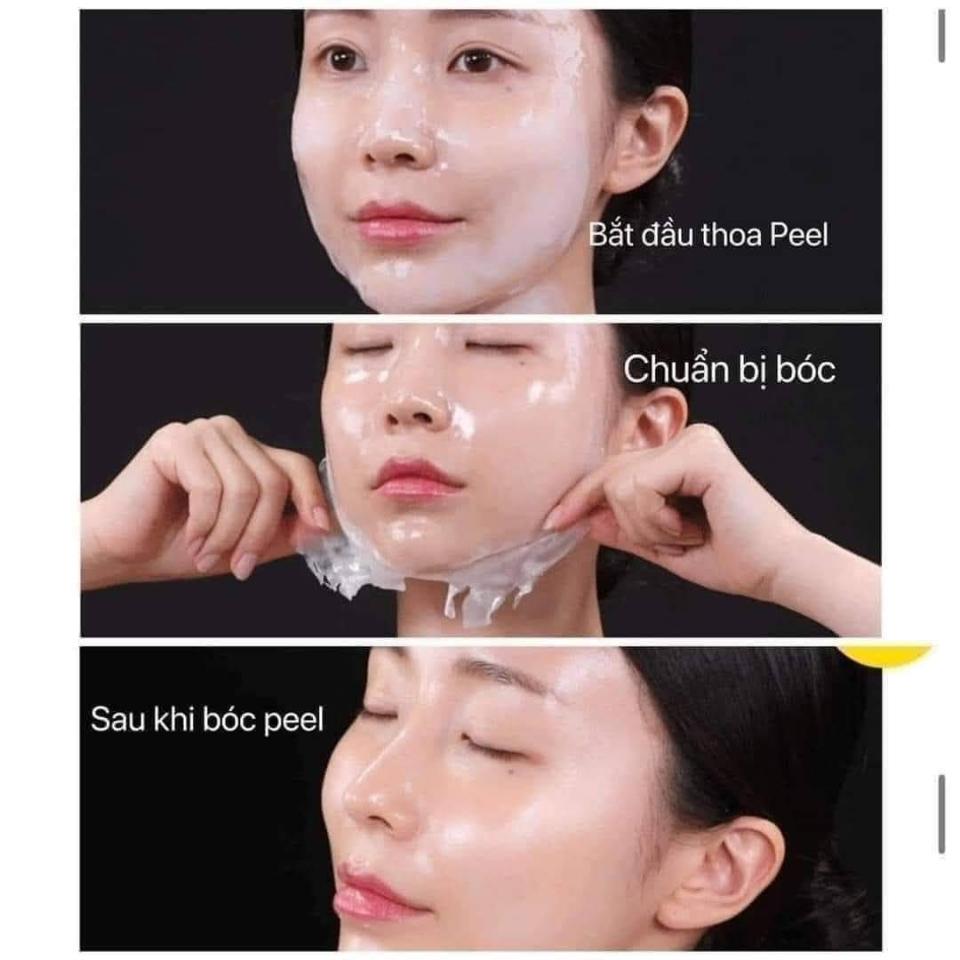 Muốn da đẹp thì cách duy nhất là Peel nha mấy b
💥Tự tin là em #Peel collagen này peel xong da đẹp căng bóng như mới tiêm bottox xong ấy.
👉 -Riêng loại này peel dễ cực kì, 1-2 tiếng Nhìn da đã khác bọt rồi.  1 lần peel bằng 3-4 tháng dưỡng da chăm chỉ nha các bà. 
Đẩy colagen vào da ngay lập tức da trở nên căng bóng, giảm nếp nhăn , rãnh cười cực hiệu quả
👇👇 -Không gây bong tróc giống các loại khác dễ Peel .
     ❌ Peel collagen nano Tosowoong Real Collagen Fit Cream Pack ❌
✅CÔNG DỤNG :
 - Collagen thuỷ phân 670.000ppm Giúp làn da mịn màng, trắng da, da khỏe mạnh và căng bóng
- Chiết xuất từ  Vitamin nhóm B : Giàu dinh dưỡng & dưỡng ẩm phục hồi da, giúp da căng bóng, trắng hồng.
- Madecassoside dưỡng ẩm cho da đặc biệt là da nhạy cảm, dịu da.
- glutathione : trắng sáng - đều màu da, chống oxy hoá.
- Tái tạo làn da giúp da trở nên căng bóng - mịn mướt .
Peel da đẹp lên ngay sau peel nhé, nhẹ nhàng, êm dịu tựa đắp mask thôi  không hề đau xót gì đâu nha🩸🩸
Mùa khô hanh này có em này, làn da như được tái sinh sau mỗi lần peel.
Peel collagen, truyền trắng, căng bóng
Giá bán lẻ 320K
Số lượng 1️⃣
☎️ 0797254043-duoc-ban-tai-PHƯƠNG LINH Shop