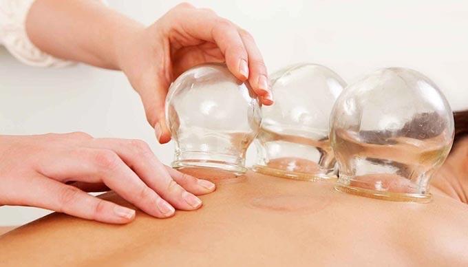 Bộ 12 Hũ Giác Hơi Thuỷ Tinh-duoc-ban-tai-ORISTORE- SỨC KHOẺ XANH