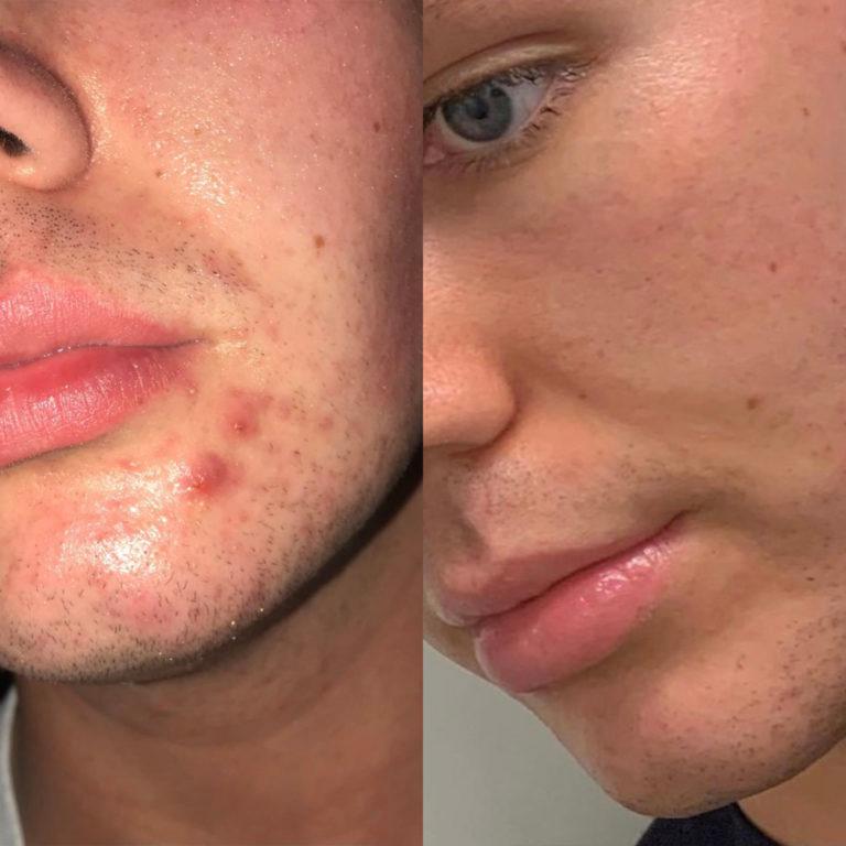 Serum cân bằng & làm sạch da Byoma | Clarifying Serum-duoc-ban-tai-Offload Spa