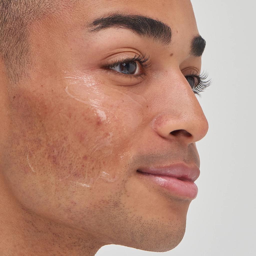 Serum giảm các dấu hiệu nám da The Inkey List | Tranxemic Acid Serum-duoc-ban-tai-Offload Spa