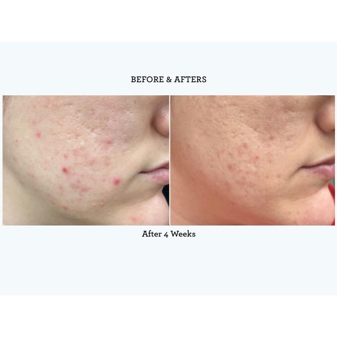 2-trong-1 toner và serum làm sạch da Bliss | Clear Genius Clarifying Toner + Serum-duoc-ban-tai-Offload Spa
