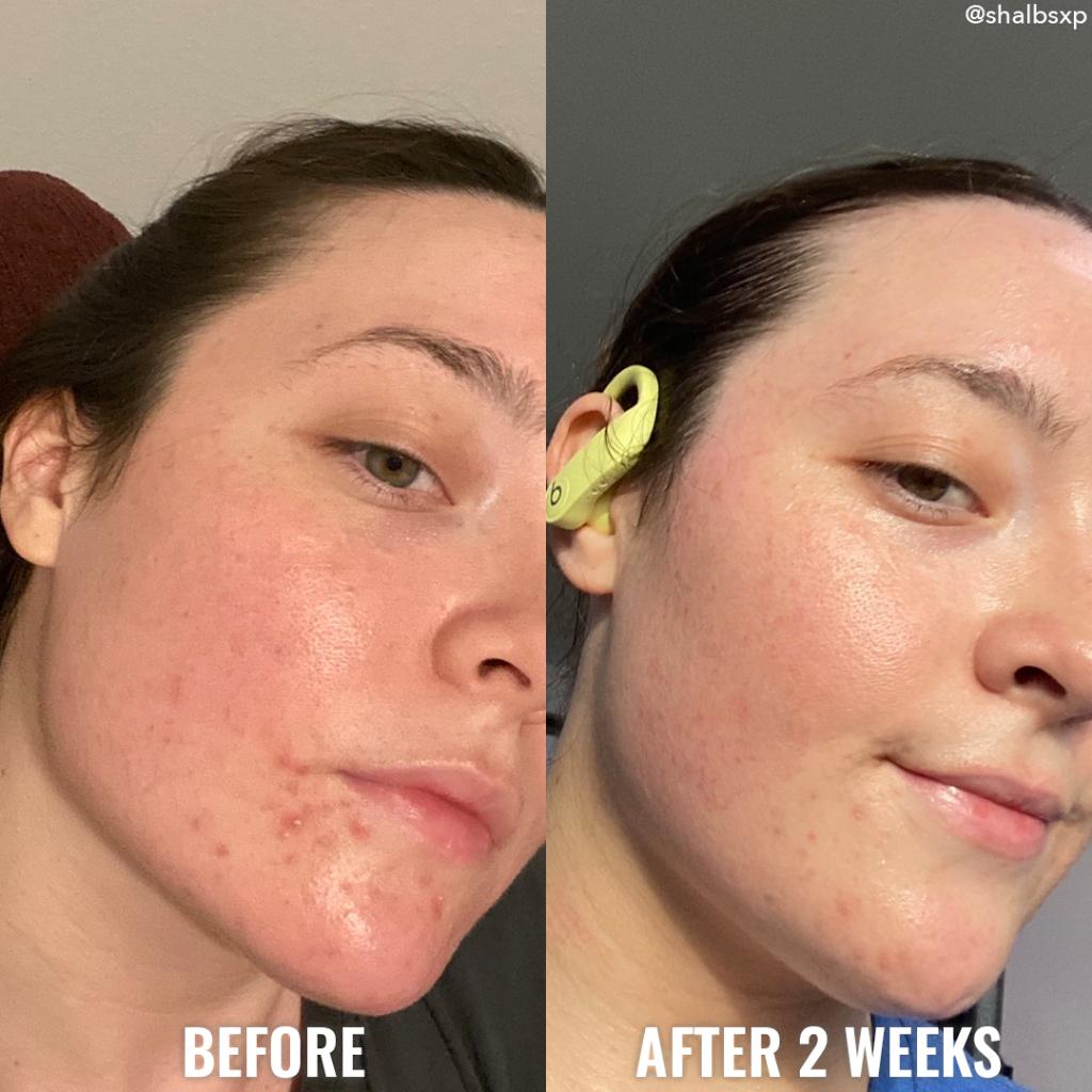 Sữa rửa mặt dạng nén cân bằng đặc biệt phù hợp da dầu mụn Good Molecules | Clarify & Cleanse Bar với Salicylic Acid-duoc-ban-tai-Offload Spa