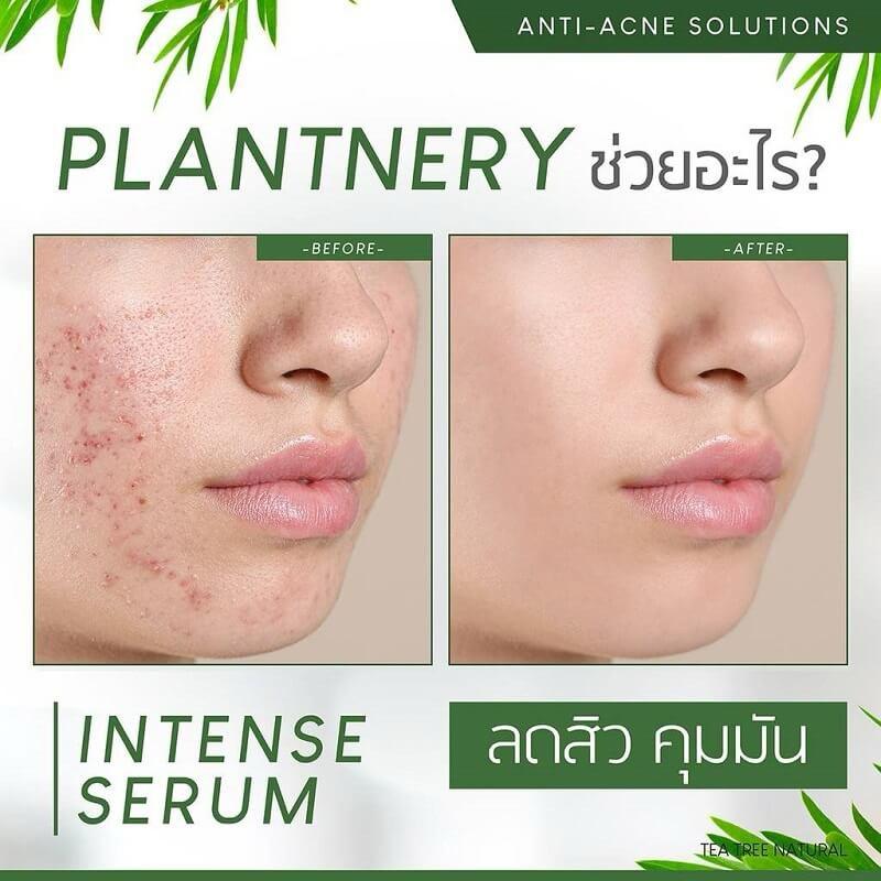 Plantnery Pomegranate First Toner, Tea Tree Toner Acne Reduction, Yuzu Orange VitC 250ml-duoc-ban-tai-Alice Boutique